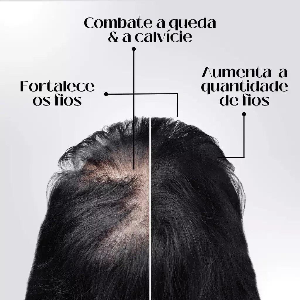 Repair Hair® | Crescimento Capilar e Combate à Queda de Cabelo