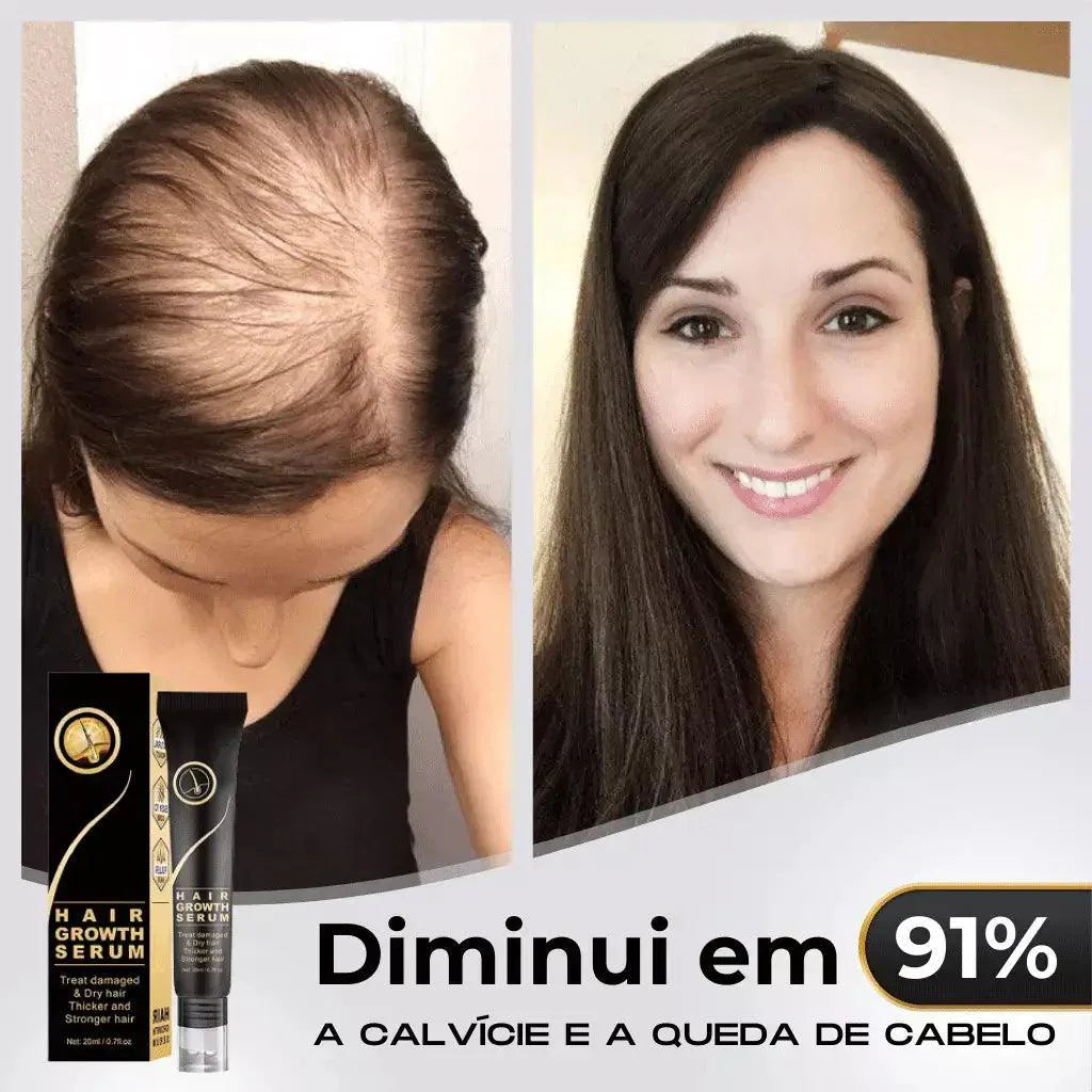 Repair Hair® | Crescimento Capilar e Combate à Queda de Cabelo