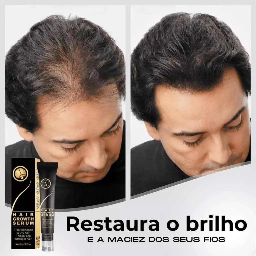 Repair Hair® | Crescimento Capilar e Combate à Queda de Cabelo