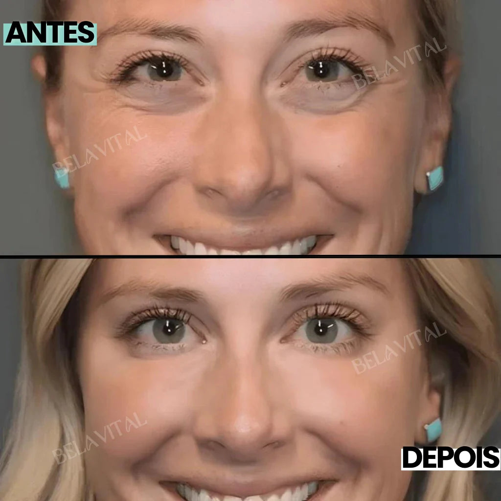 Celyn: Creme para Olheiras e Rejuvenescimento dos Olhos Avançado