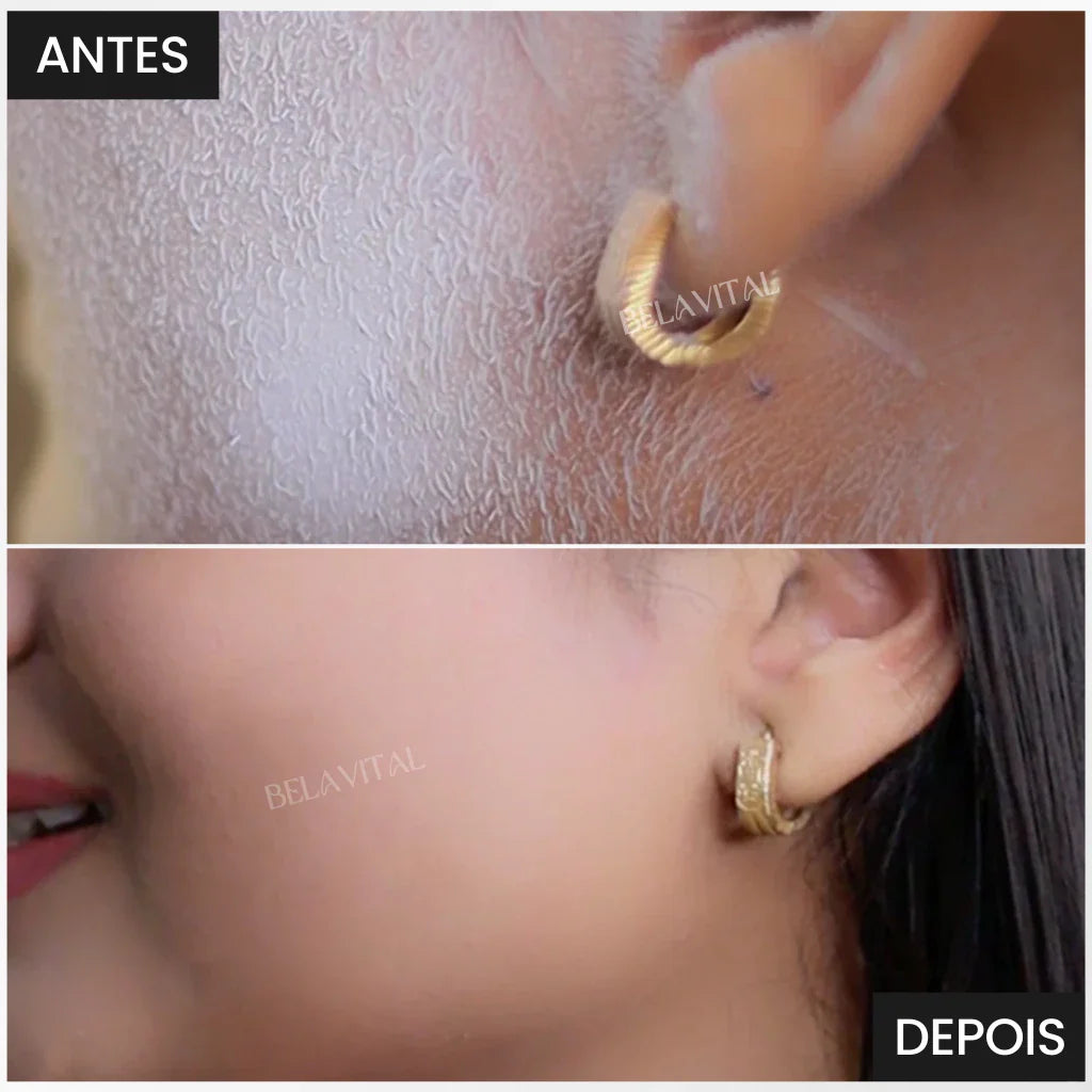 Bela Spray | Identificador de Pelos Invisíveis