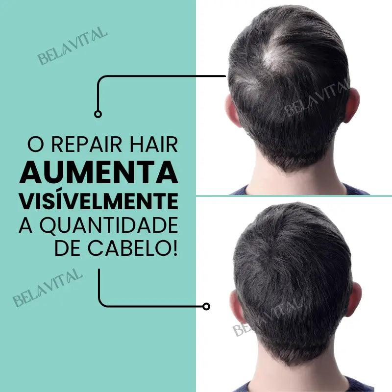 Kit Repair Hair Pro+ com Brinde Exclusivo: O Tratamento Mais Completo Contra Queda de Cabelo e a Calvície!