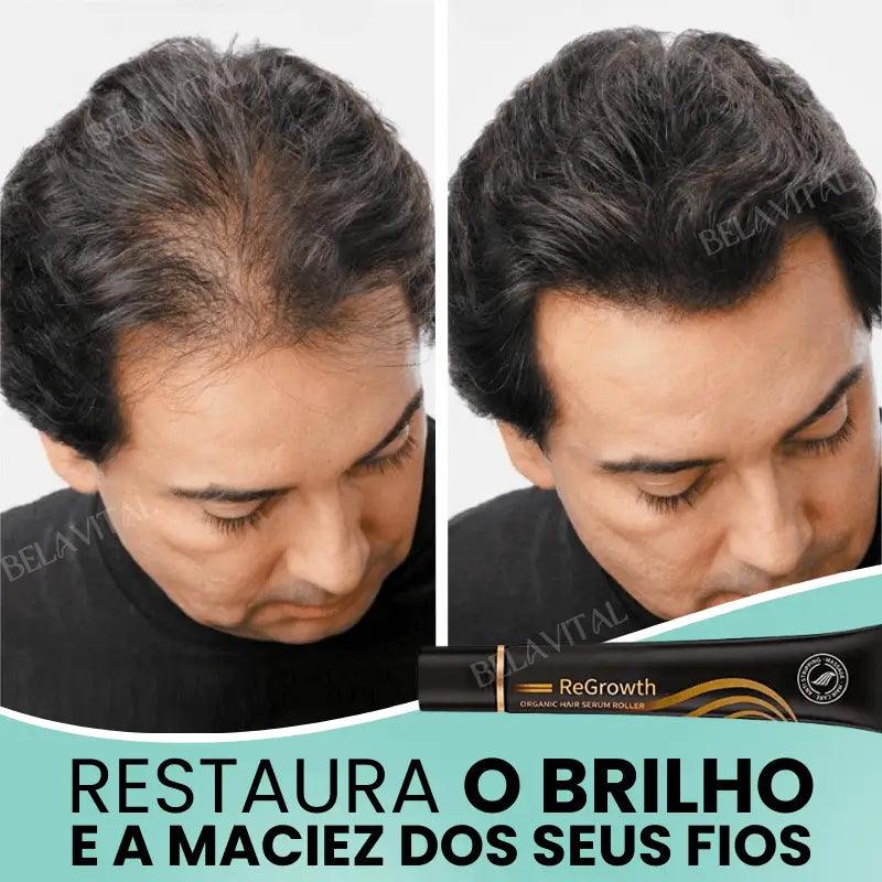 Kit Repair Hair Pro+ com Brinde Exclusivo: O Tratamento Mais Completo Contra Queda de Cabelo e a Calvície!