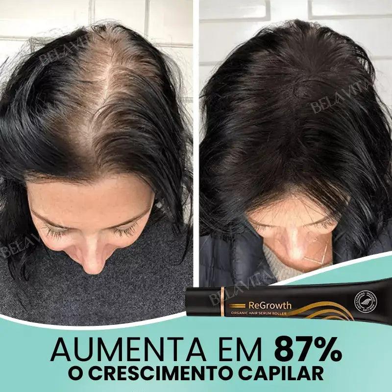 Kit Repair Hair Pro+ com Brinde Exclusivo: O Tratamento Mais Completo Contra Queda de Cabelo e a Calvície!