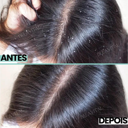 Shampoo Anti Caspa: PurcBlue com Algas Marinhas